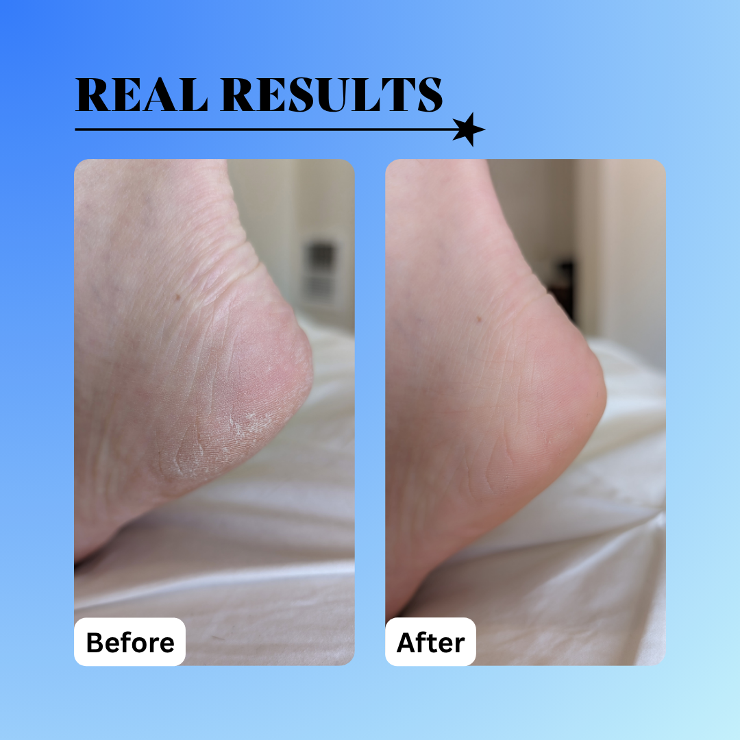 10% Glycolic Exfoliating Treatment Tonic - Trending Wellness Store