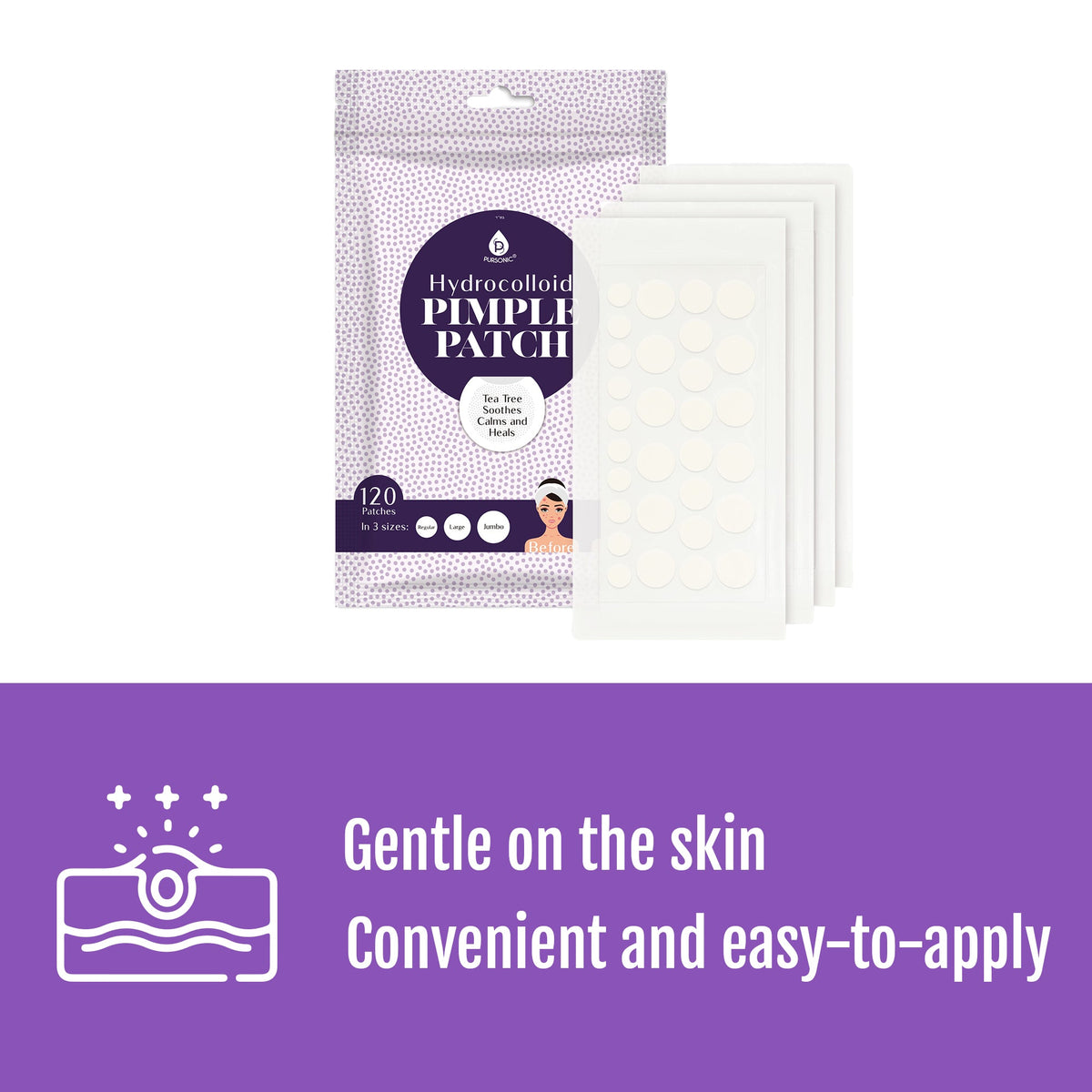 Hydrocolloid Pimple Patch, 120-Count, Multi Size Acne Solution 5 Pack - Trending Wellness Store
