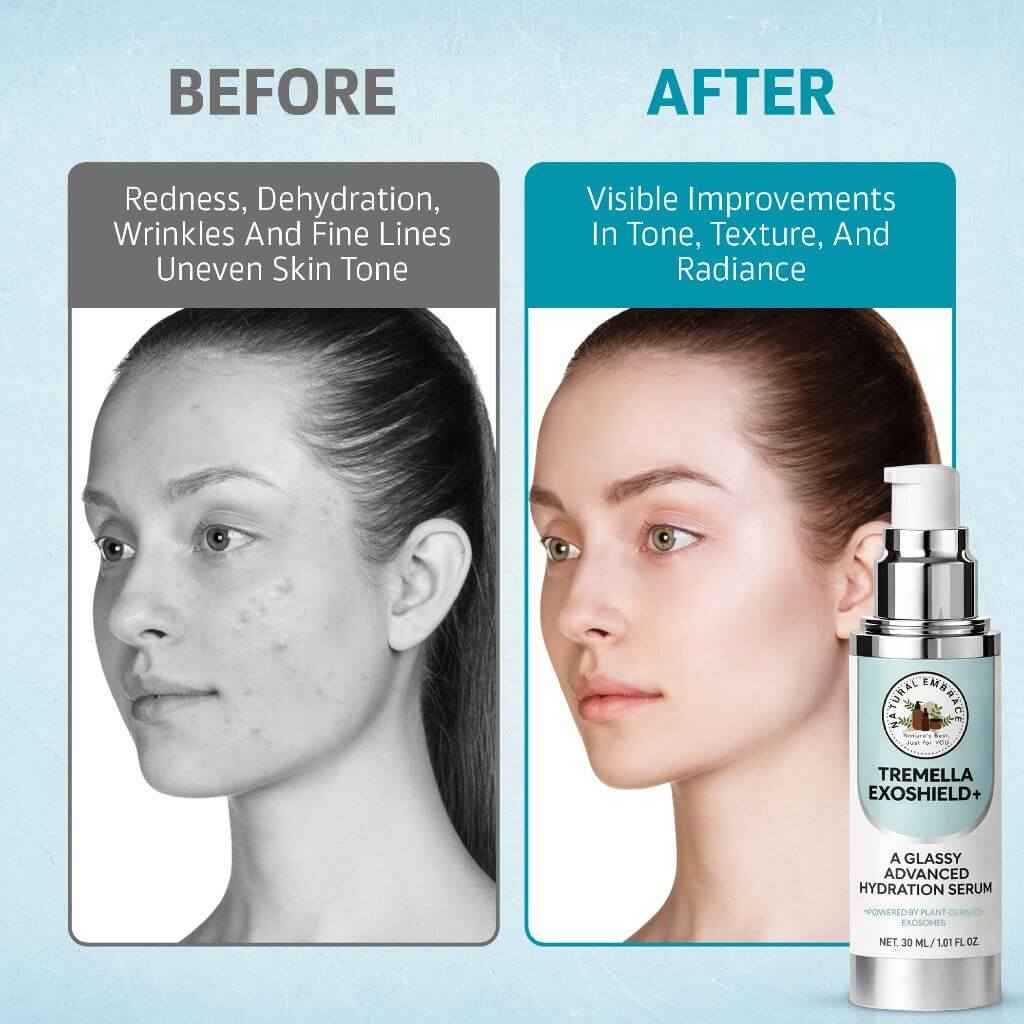 Natural Embrace Tremella Exoshield+ 3-in-1 | Hydrating Lift Serum, Exosome Glow Booster & Glass Skin Primer