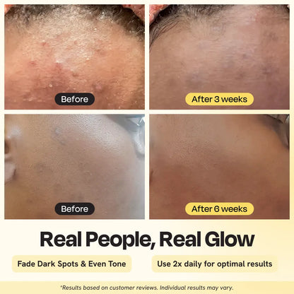 Advanced Brightening Moisturizer - Trending Wellness Store
