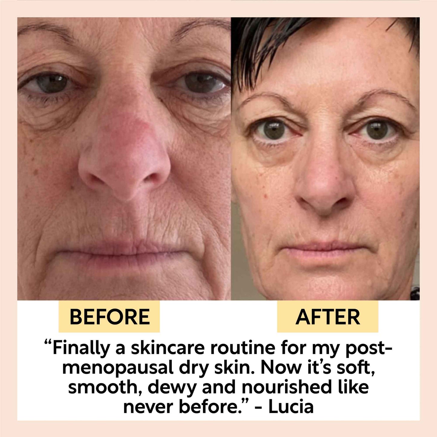Anti-Aging Skincare Bundle - Trending Wellness Store