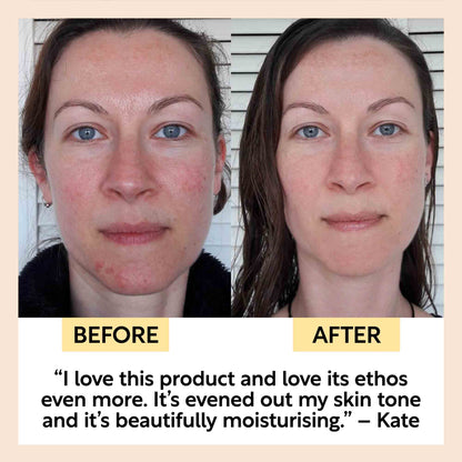 Anti-Aging Skincare Bundle - Trending Wellness Store