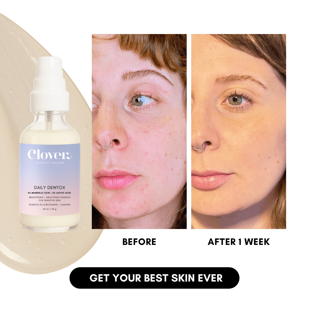 Daily Dewtox Smoothing & Brightening Essence - Trending Wellness Store