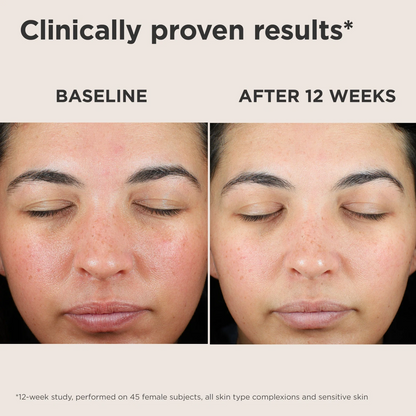 EltaMD UV Skin Recovery Red Color Correcting Green Tint Broad Spectrum SPF 50 - Trending Wellness Store