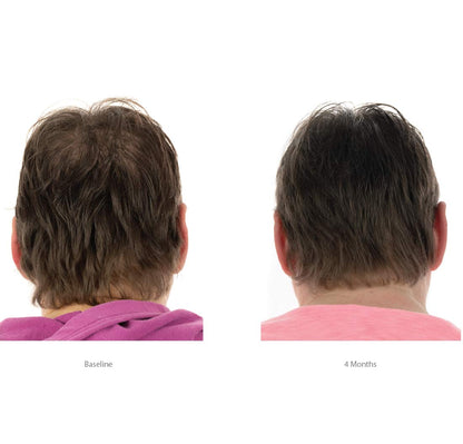 FOLIGAIN® Hair Growth Shampoo + Conditioner Kit For Women with 2% TRIOXIDIL®