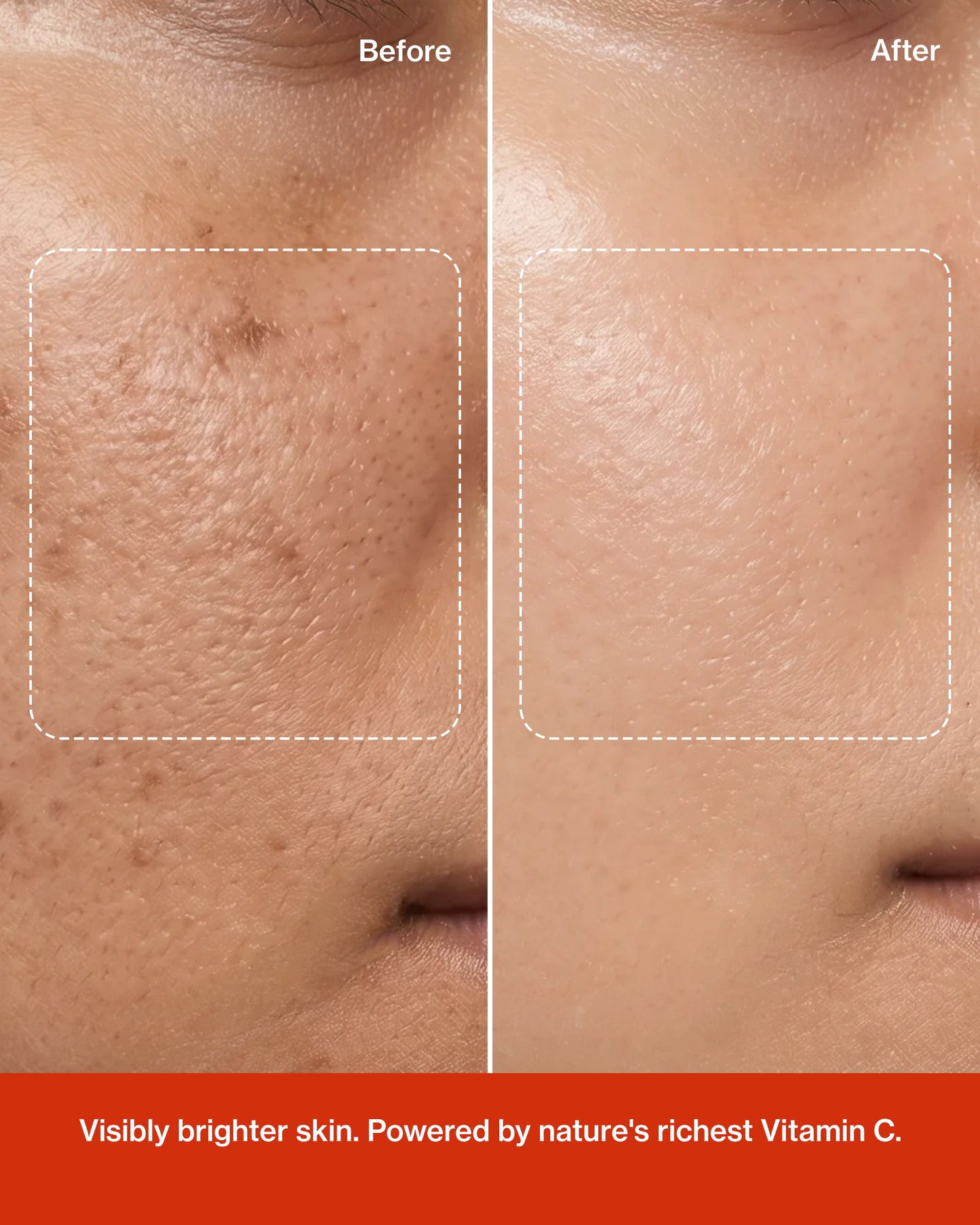 Glow Vitamin C Skin  Brightening Serum - Trending Wellness Store
