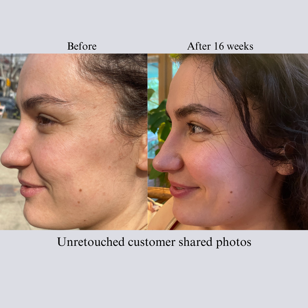 Hyaluron 3D Hydrator-Multi Lamellar Emulsion The Advanced Response Face and Neck Cream-Serum - Trending Wellness Store