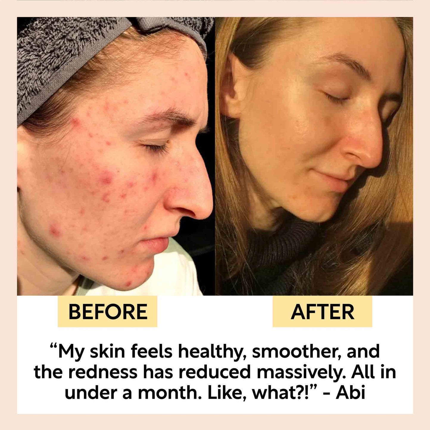 Kaolin Clay Face Mask - Trending Wellness Store