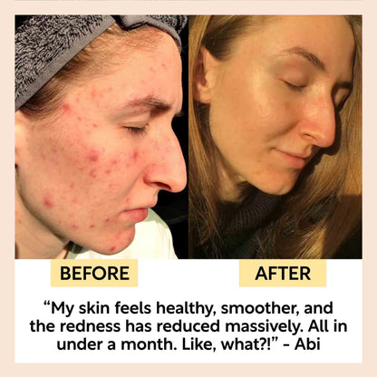 Kaolin Clay Face Mask - Trending Wellness Store