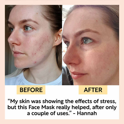 Kaolin Clay Face Mask - Trending Wellness Store