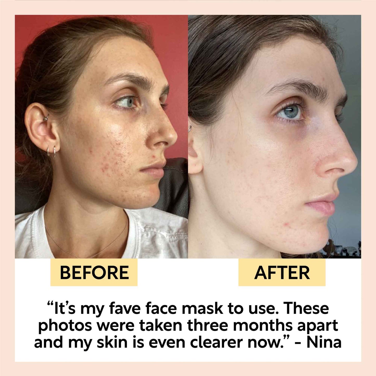 Kaolin Clay Face Mask - Trending Wellness Store