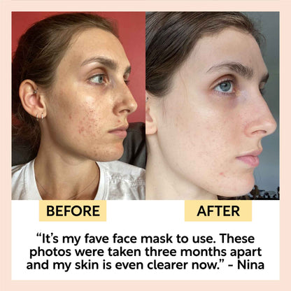 Kaolin Clay Face Mask - Trending Wellness Store