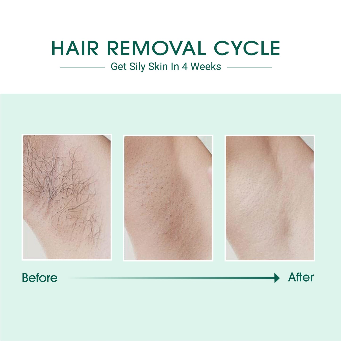 Laser IPL Hair Removal - Trending Wellness Store