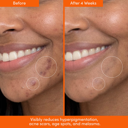 MANE SQUEEZE Tinted SPF + Dark Spot Serum Bundle - Trending Wellness Store