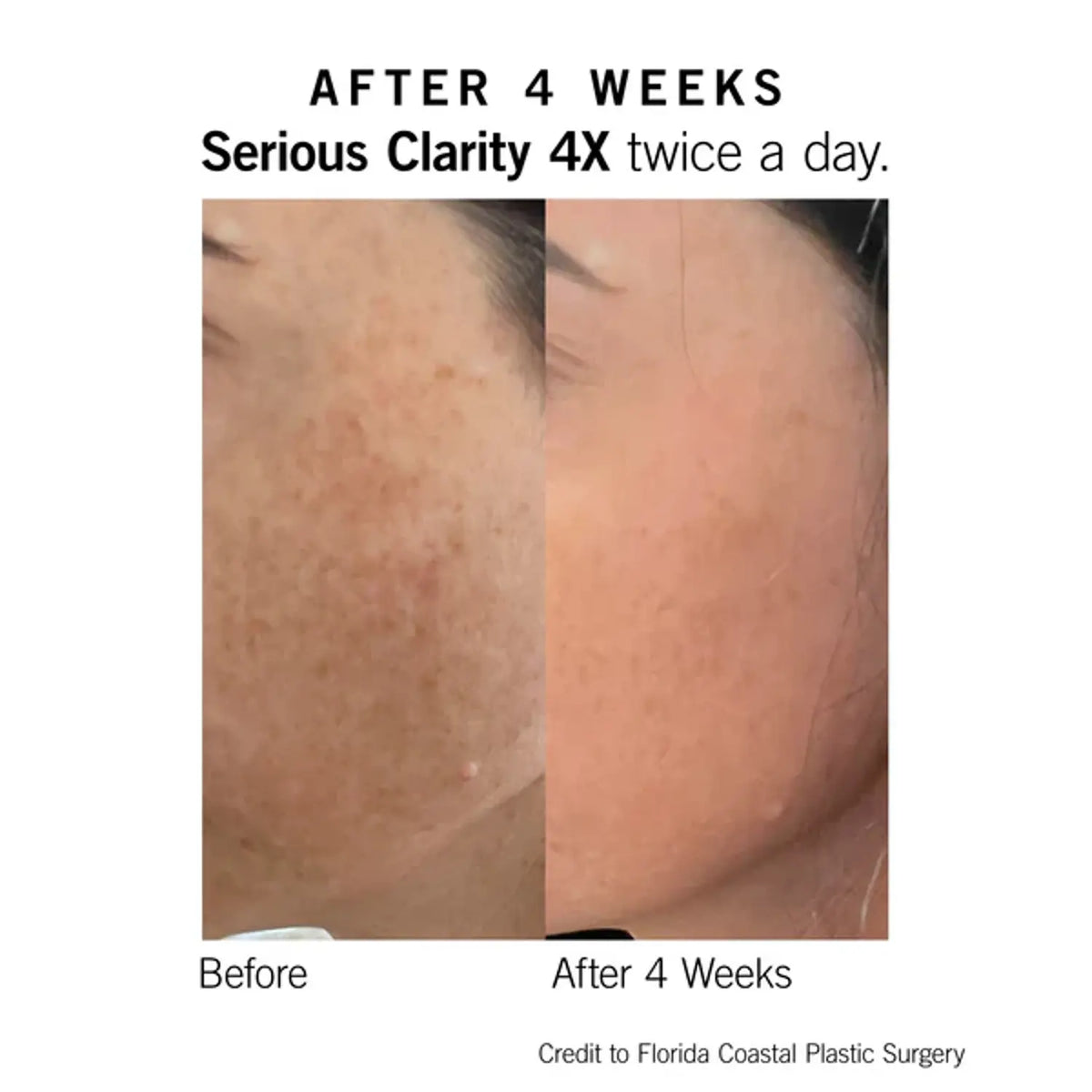 Neova Serious Clarity 4X 1 Oz - Trending Wellness Store