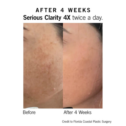 Neova Serious Clarity 4X 1 Oz - Trending Wellness Store