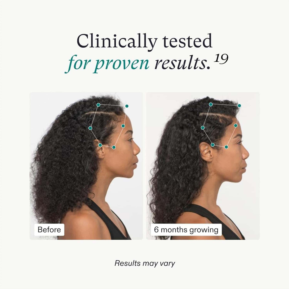 Nutrafol Women's Vegan Hair Growth Supplement Pack 3-Month Supply - Trending Wellness Store