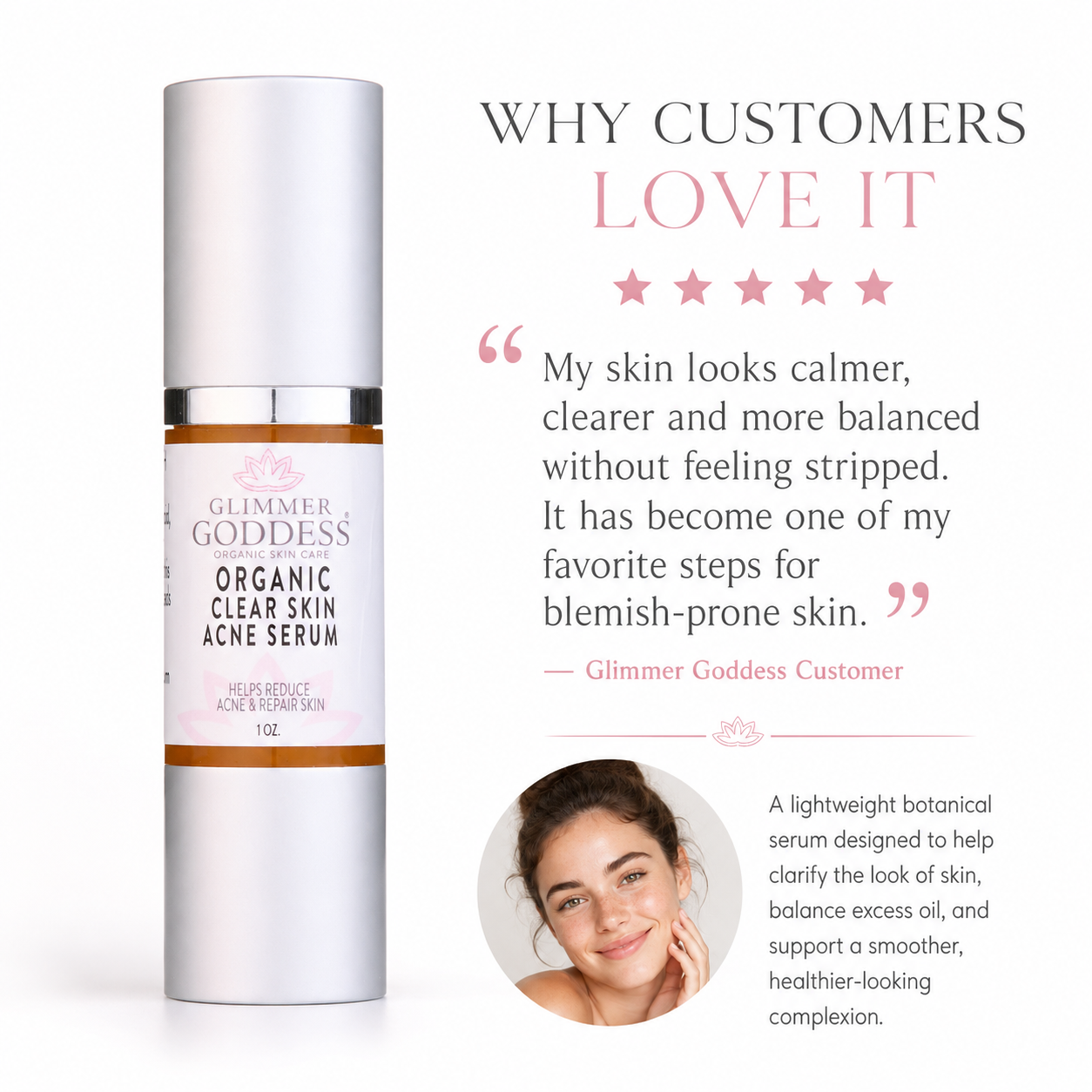 Organic Acne Serum – Oil Control & Pore Clearing Treatment - Trending Wellness Store
