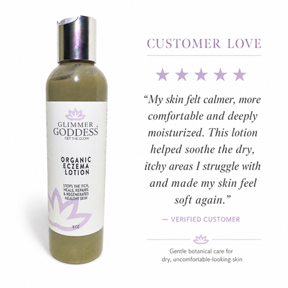Organic Eczema Lotion – Soothing Relief & Skin Healing - Trending Wellness Store