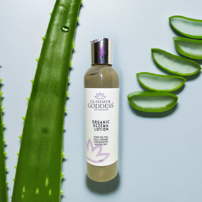 Organic Eczema Lotion - Stop the Itch, Heal The Skin - Trending Wellness Store