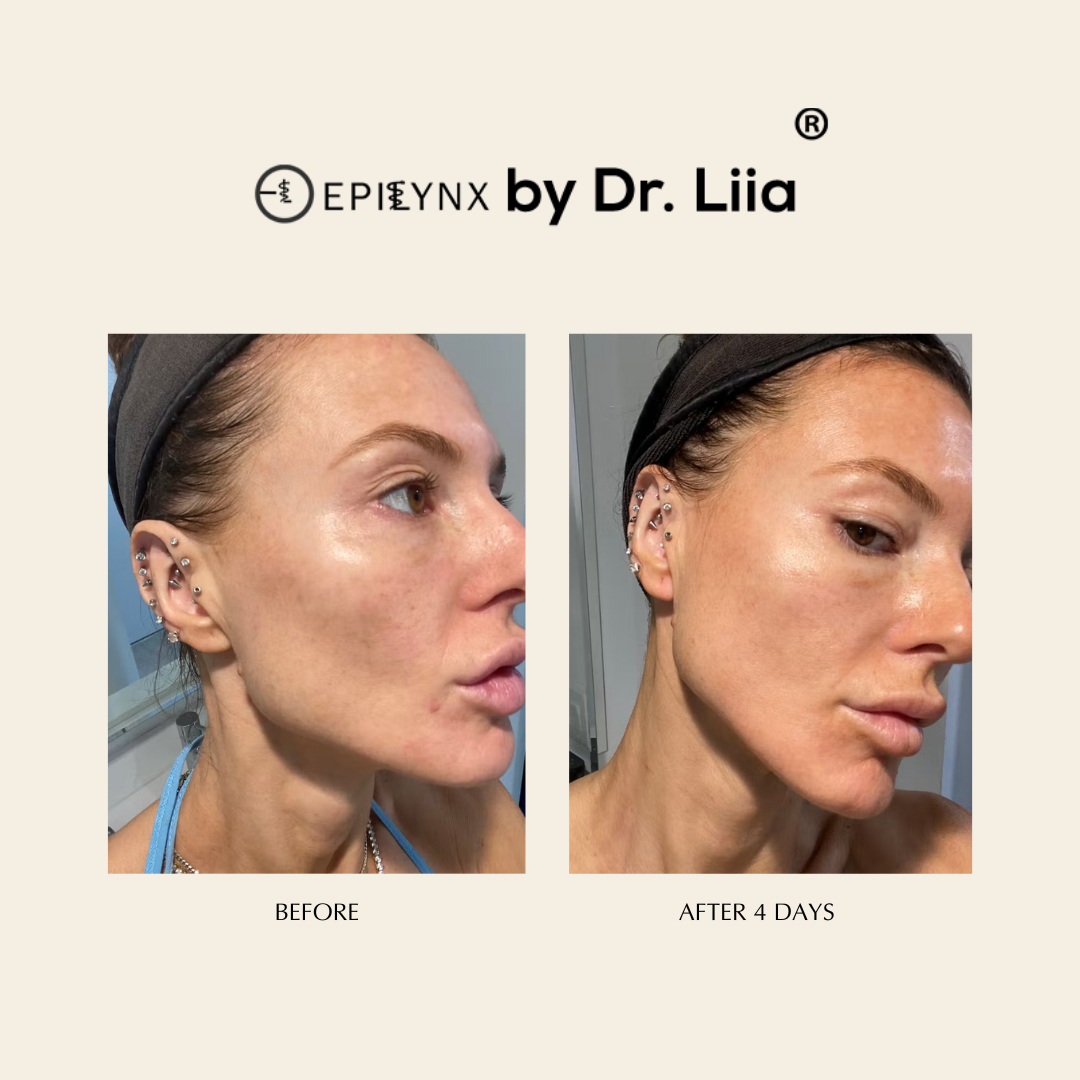 Pore Refining, Illuminating Serum with Lactic and Salicylic Acid - Gentle - Trending Wellness Store