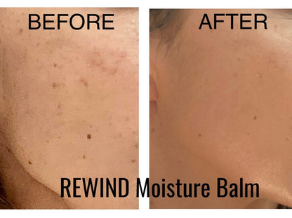 REWIND Hydrating Face Balm with Vitamin C - Trending Wellness Store