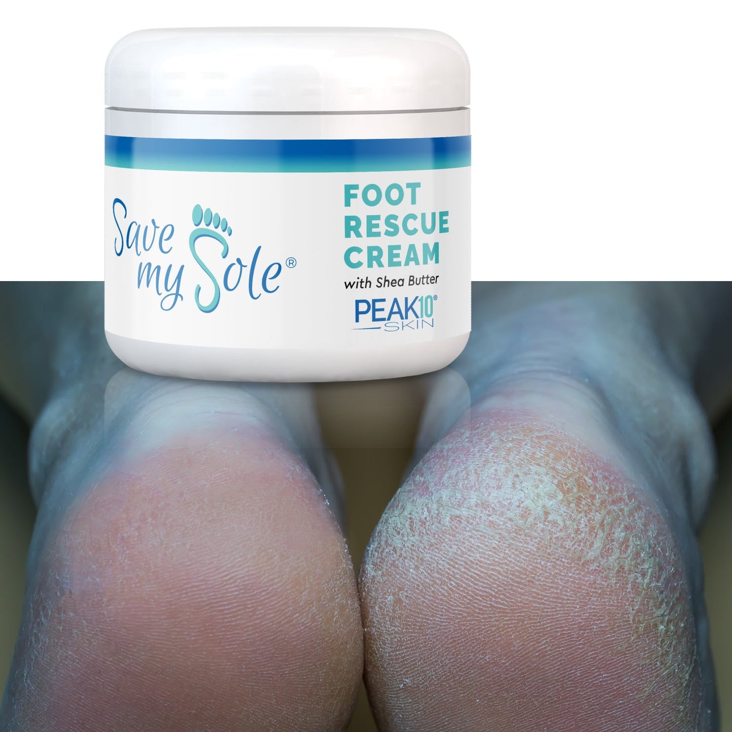 SAVE MY SOLE® foot cream w/Shea Butter 4.2 oz - Trending Wellness Store