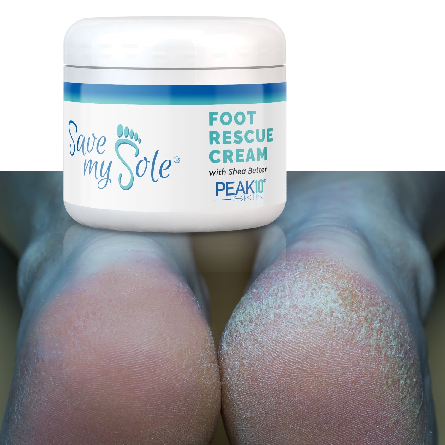 SAVE MY SOLE® foot cream w/Shea Butter 4.2 oz - Trending Wellness Store