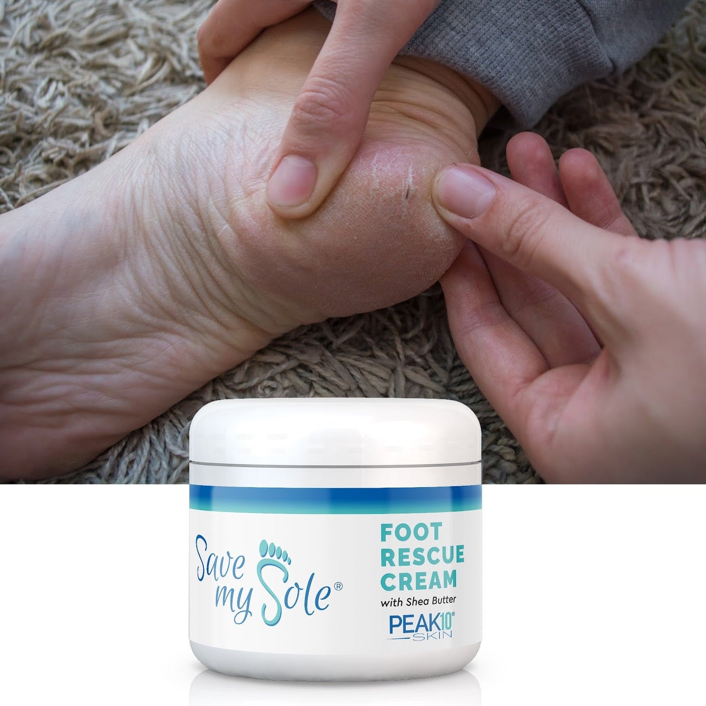 SAVE MY SOLE® foot cream w/Shea Butter 4.2 oz - Trending Wellness Store