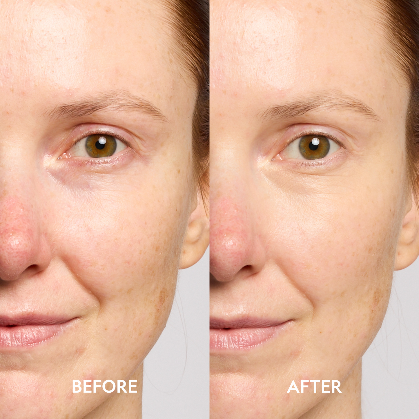 Super Bright Dark Circle Serum Peptide Corrector - Trending Wellness Store