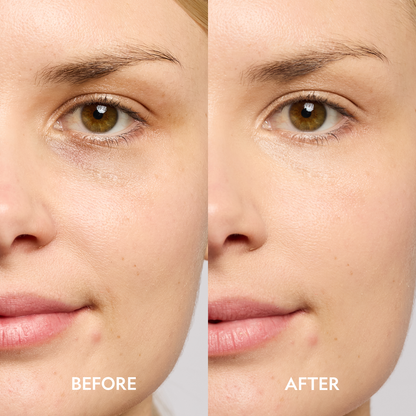 Super Bright Dark Circle Serum Peptide Corrector - Trending Wellness Store