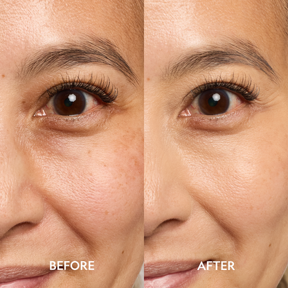 Super Bright Dark Circle Serum Peptide Corrector - Trending Wellness Store