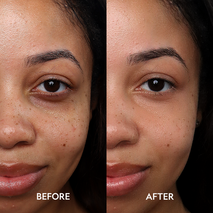 Super Bright Dark Circle Serum Peptide Corrector - Trending Wellness Store