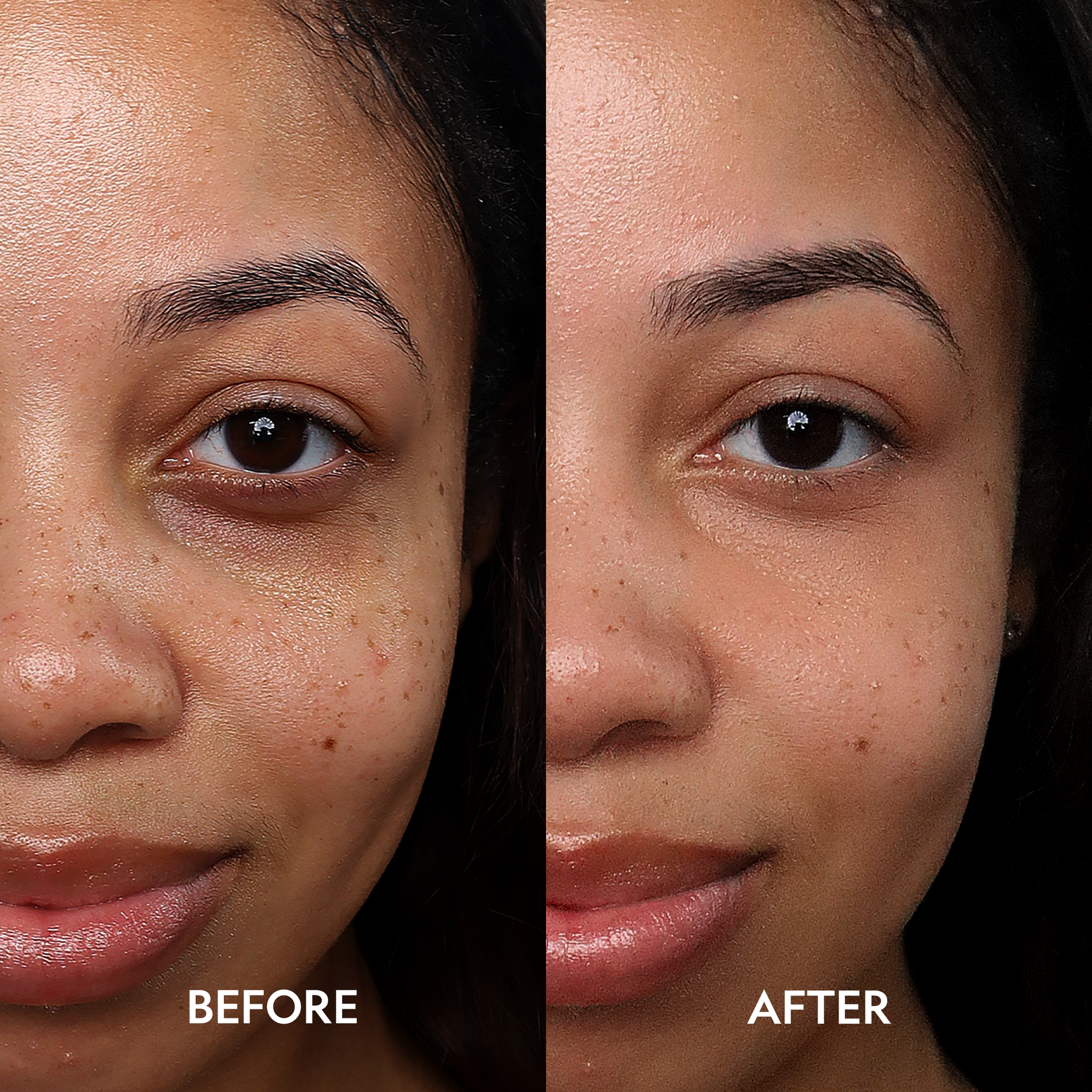 Super Bright Dark Circle Serum Peptide Corrector - Trending Wellness Store