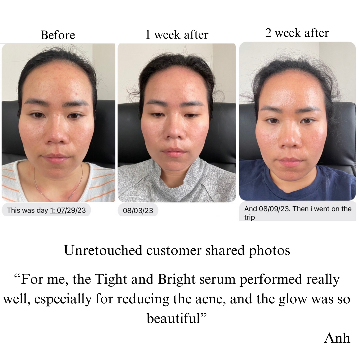 TIGHT AND BRIGHT, an Advanced Gentle Phyto-Retinol and Vitamin C Face Serum, 12 Innovative Technologies, 55% High-Performance Cosmeceuticals - Trending Wellness Store