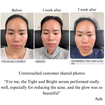 TIGHT AND BRIGHT, an Advanced Gentle Phyto-Retinol and Vitamin C Face Serum, 12 Innovative Technologies, 55% High-Performance Cosmeceuticals - Trending Wellness Store