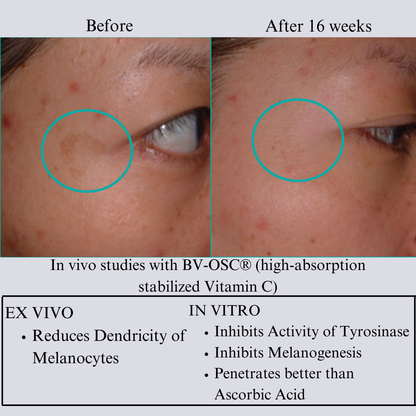 TIGHT AND BRIGHT, an Advanced Gentle Phyto-Retinol and Vitamin C Face Serum, 12 Innovative Technologies, 55% High-Performance Cosmeceuticals - Trending Wellness Store