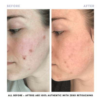 The Double Cleansing Duo - Trending Wellness Store