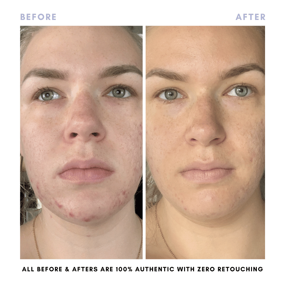 The Double Cleansing Duo - Trending Wellness Store