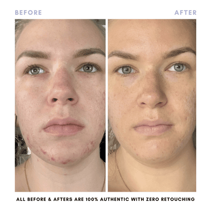 The Double Cleansing Duo - Trending Wellness Store