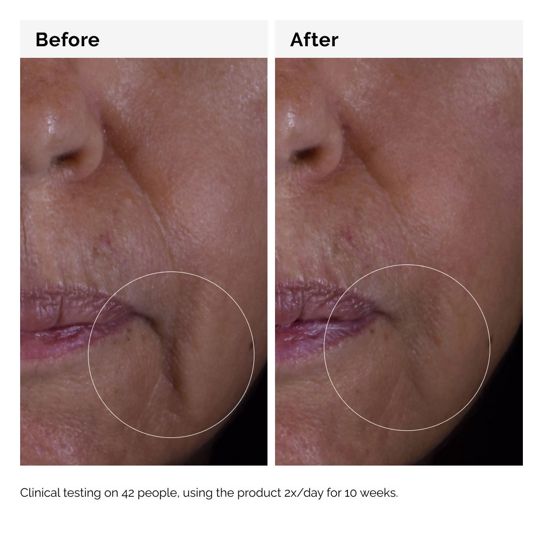 The Ordinary Growth Factors Solution 15% Serum - Trending Wellness Store