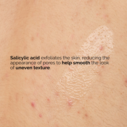 The Ordinary Salicylic Acid 0.5% Body Serum - Trending Wellness Store