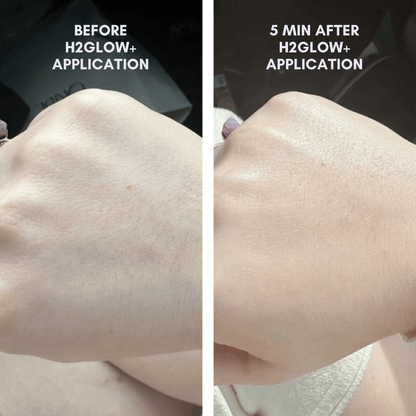 The Skin Reset Starter Kit - Trending Wellness Store