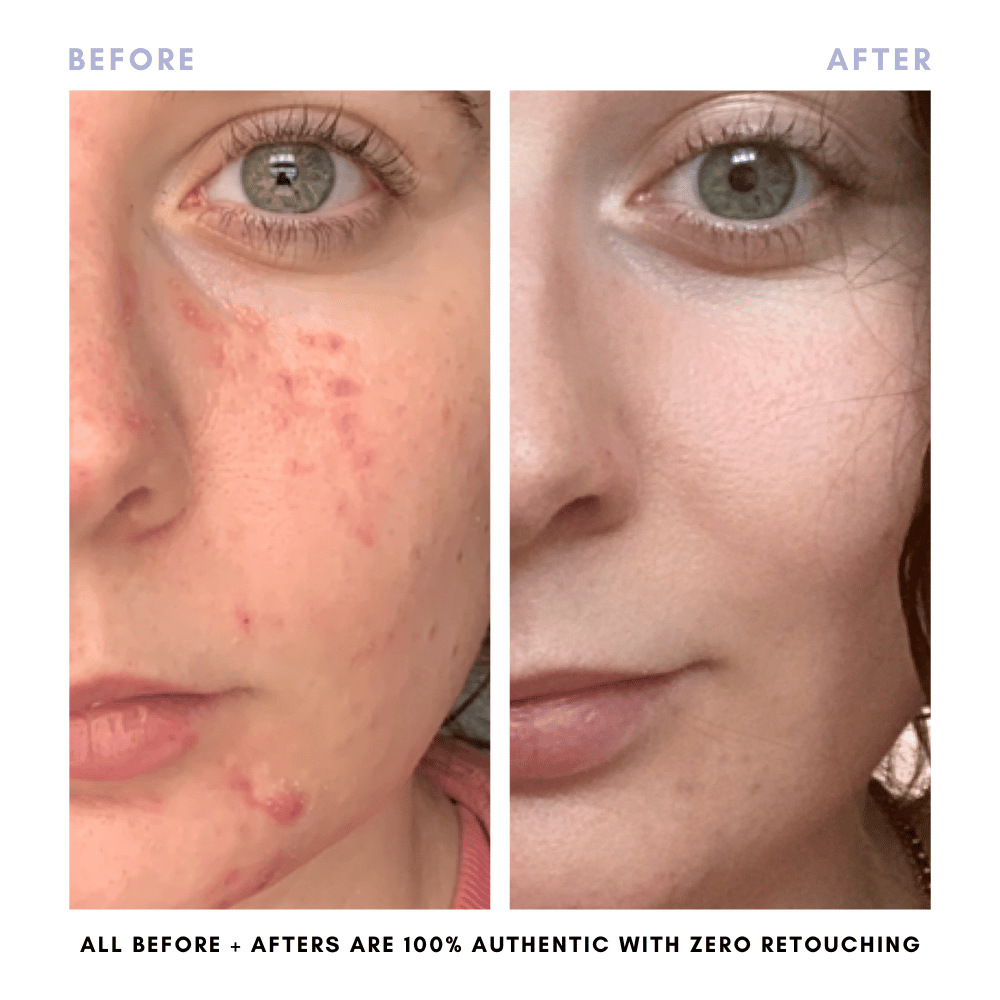 The Skin Reset Starter Kit - Trending Wellness Store