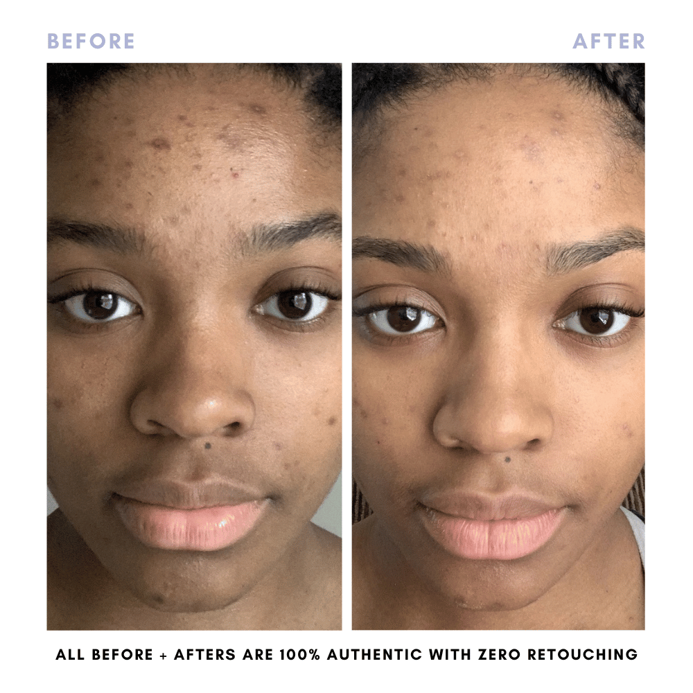 The Skin Reset Starter Kit - Trending Wellness Store