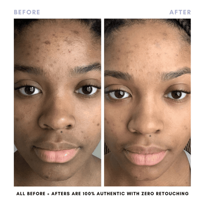 The Skin Reset Starter Kit - Trending Wellness Store