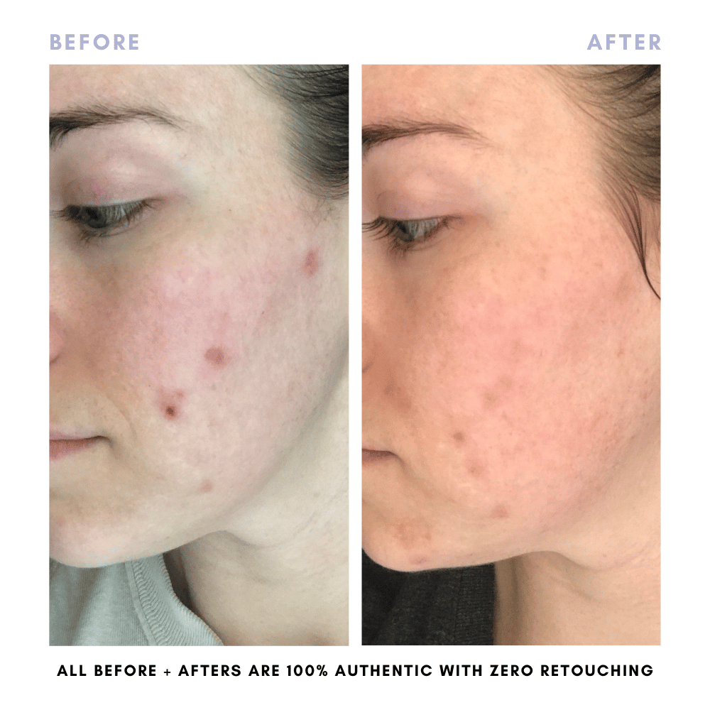 The Skin Reset Starter Kit - Trending Wellness Store