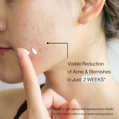 Ultra Clarifying Skin Booster - Trending Wellness Store