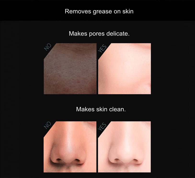 Volcanic Stone Oil-Absorbing Face Roller - Trending Wellness Store