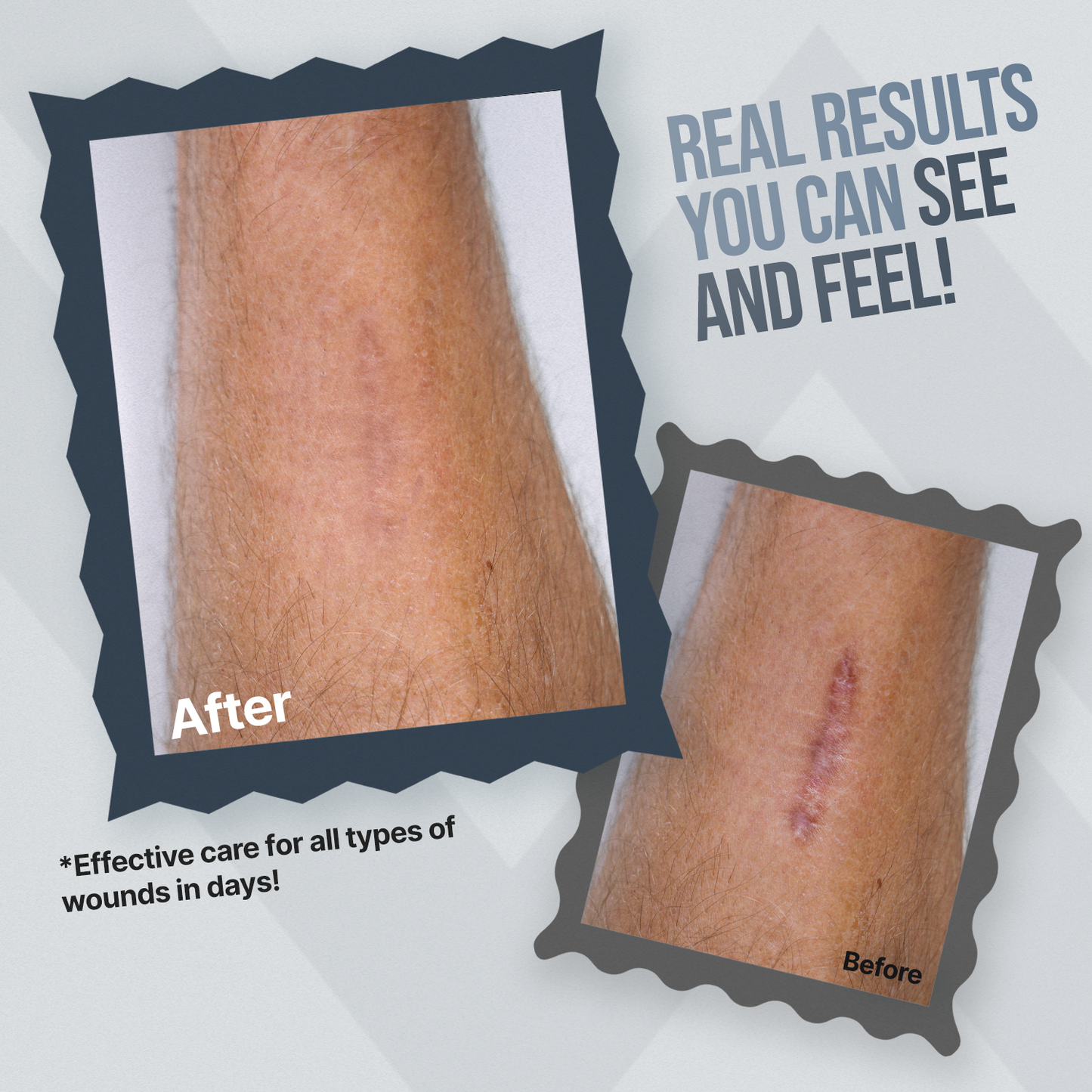 WoundWorx Wound Gel - Trending Wellness Store